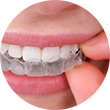 implant