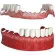 implant
