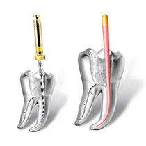 dental treatment